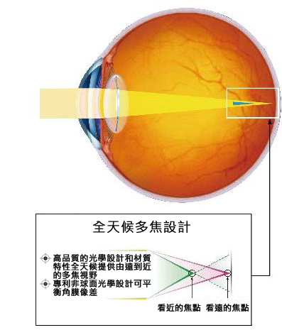 透視明多焦點人工水晶體