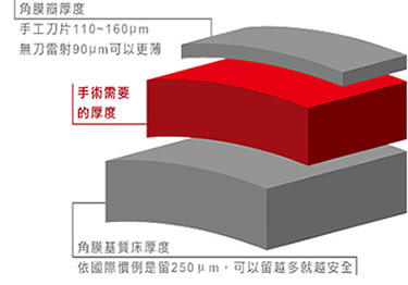 手術需要的角膜厚度