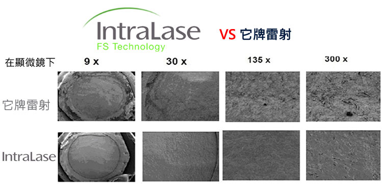 雷射能量較他牌精密，能夠對角膜作出更精準的切割