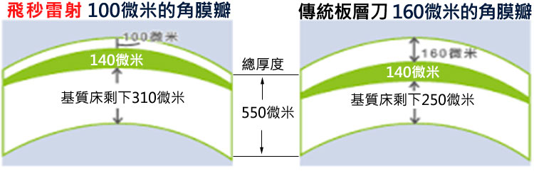 製瓣過程可全程監控，先做基質床汽化，後做瓣緣切割，若有異狀可終止，不會造成不可逆的後果 。