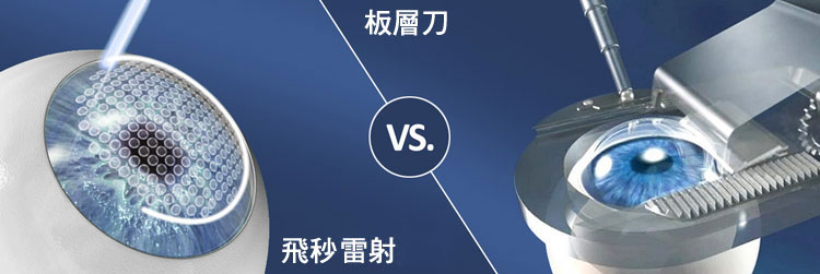 板層刀 vs 飛秒雷射