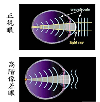 高階像差vs前導波