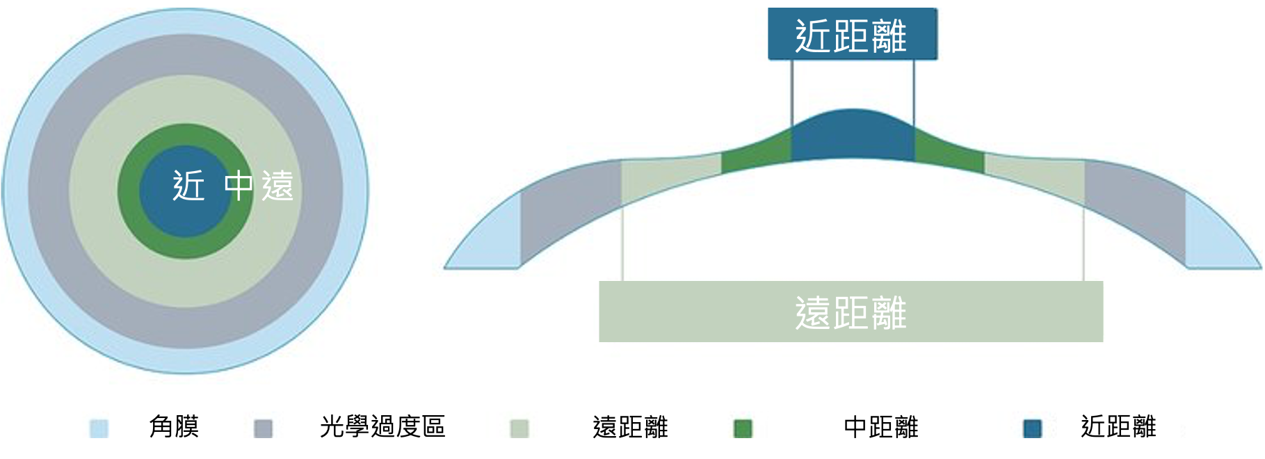 老花多焦點雷射