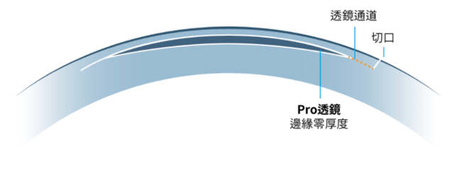 CLEAR的Pro角膜透鏡