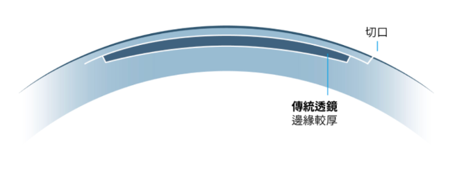 蔡司傳統加厚邊切透鏡